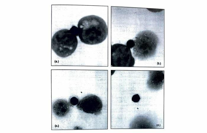 NK-cell-nici-rakovinu